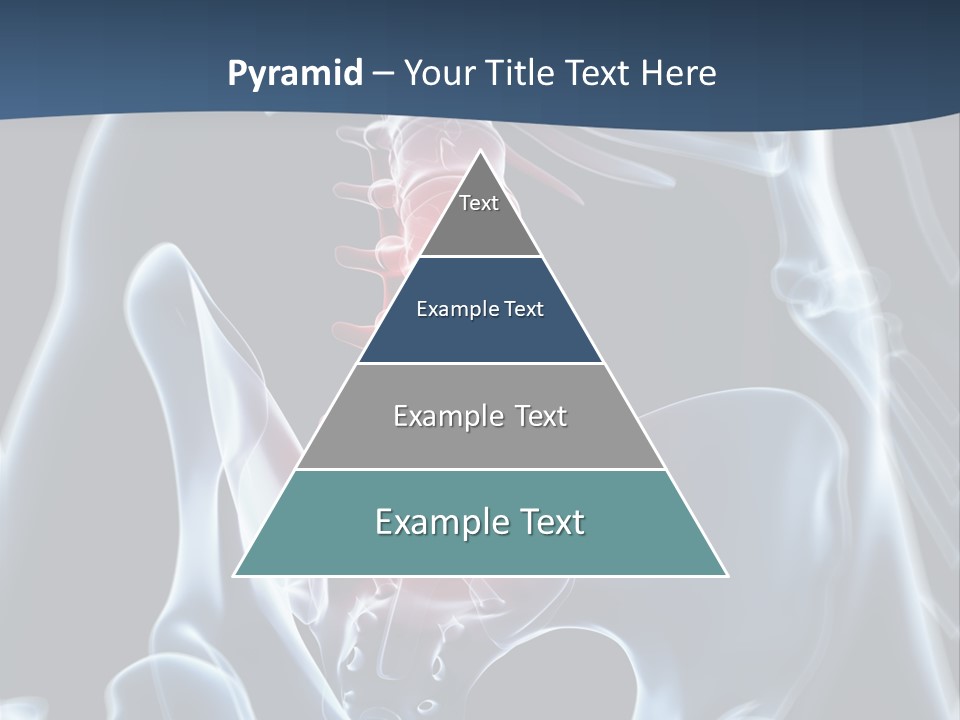 Prolapse Nerve Canal PowerPoint Template