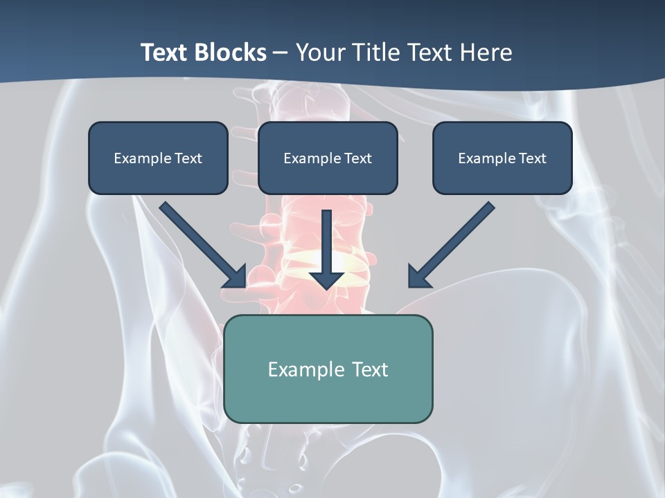 Prolapse Nerve Canal PowerPoint Template