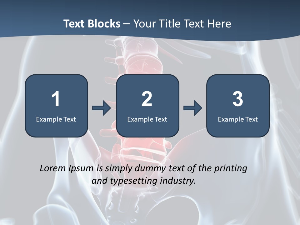 Prolapse Nerve Canal PowerPoint Template