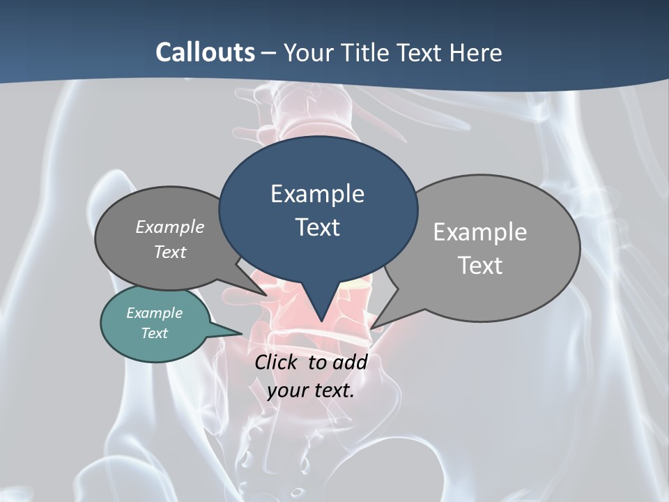 Prolapse Nerve Canal PowerPoint Template