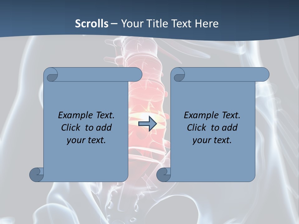Prolapse Nerve Canal PowerPoint Template