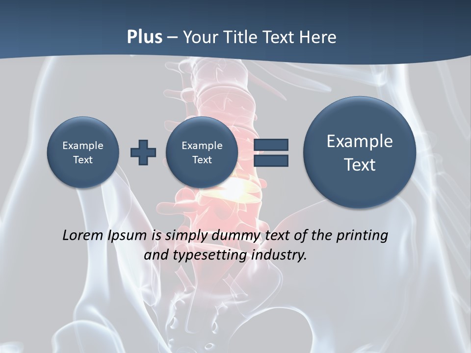 Prolapse Nerve Canal PowerPoint Template
