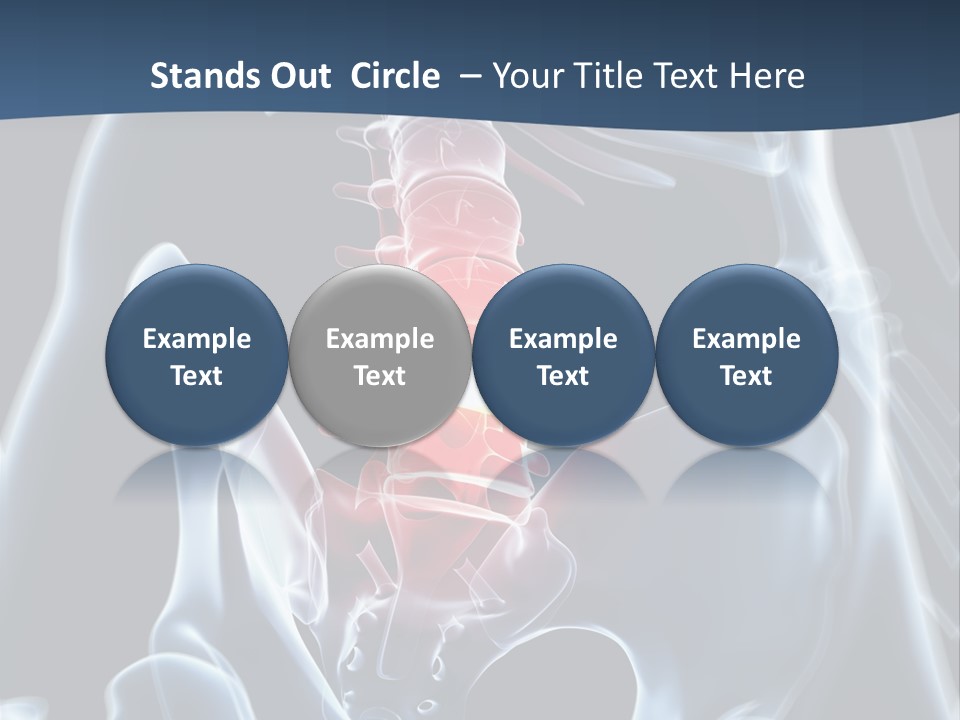 Prolapse Nerve Canal PowerPoint Template