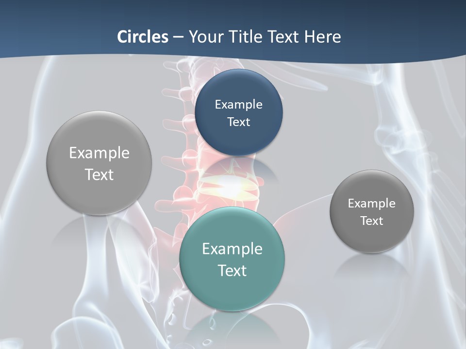 Prolapse Nerve Canal PowerPoint Template