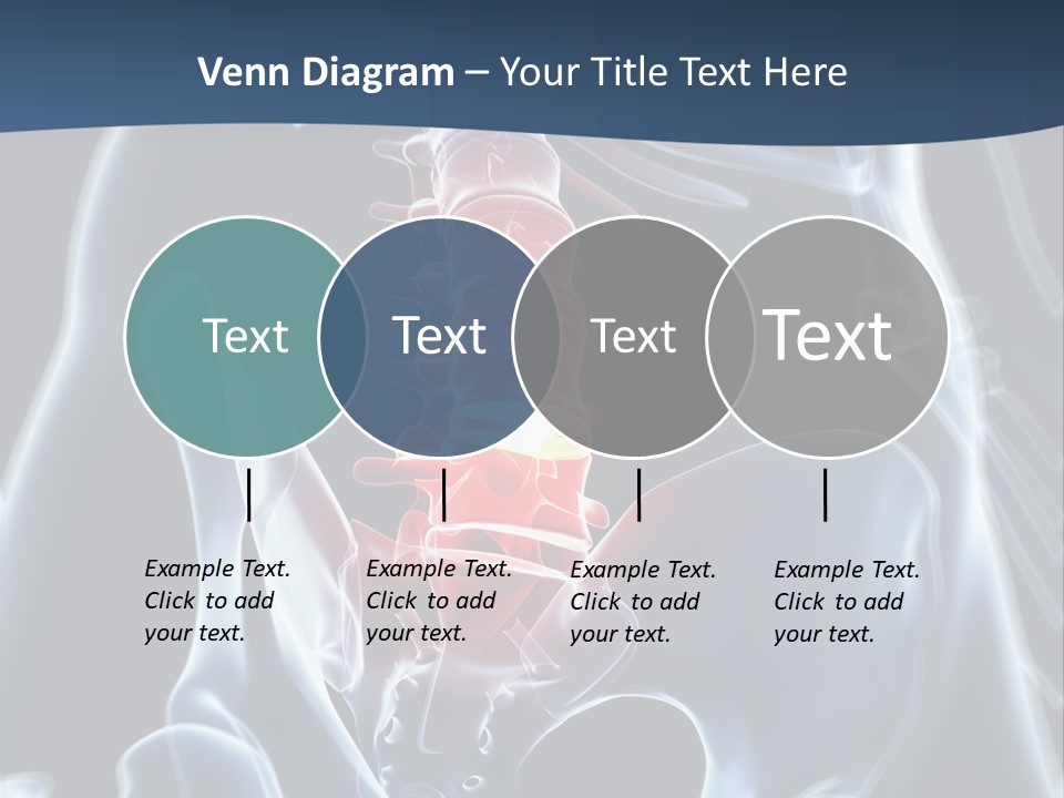 Prolapse Nerve Canal PowerPoint Template