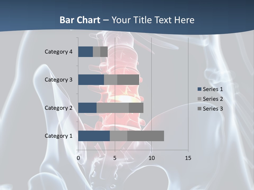 Prolapse Nerve Canal PowerPoint Template