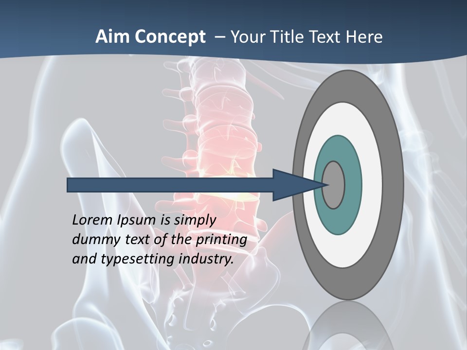 Prolapse Nerve Canal PowerPoint Template