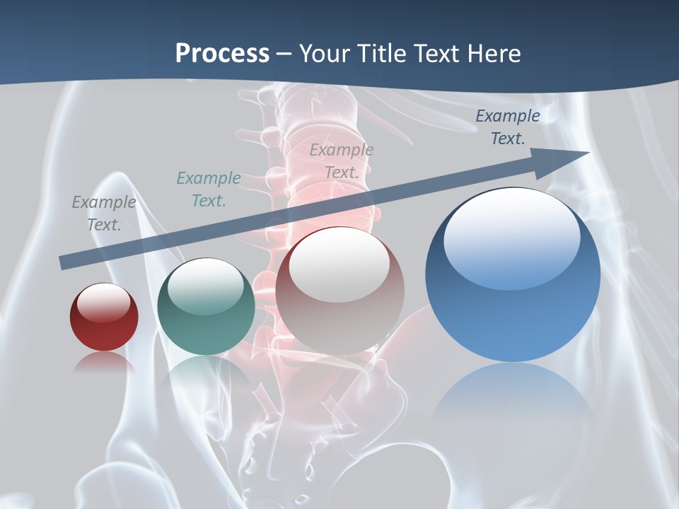 Prolapse Nerve Canal PowerPoint Template