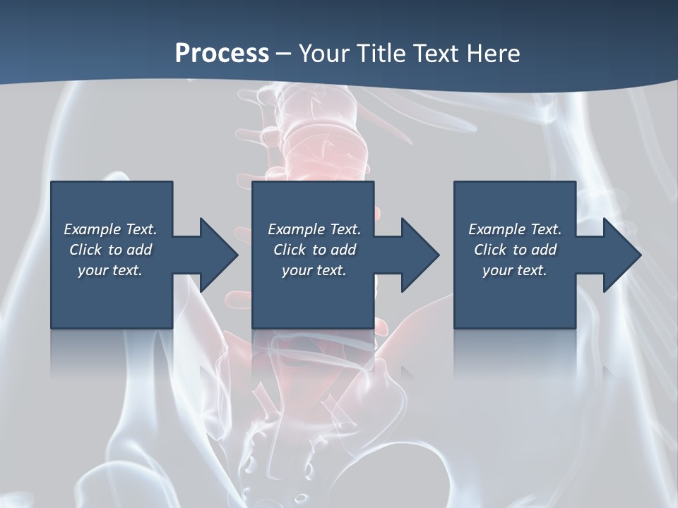 Prolapse Nerve Canal PowerPoint Template