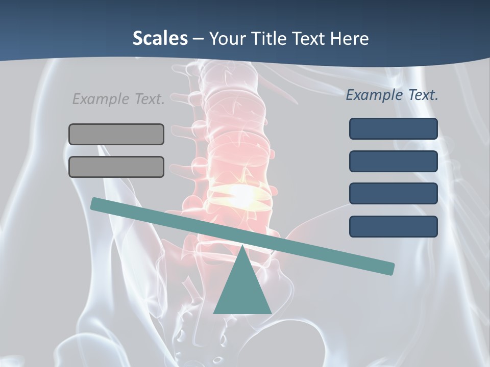 Prolapse Nerve Canal PowerPoint Template