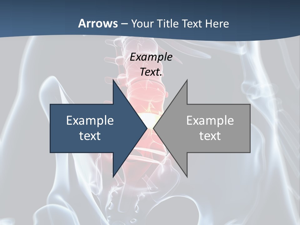 Prolapse Nerve Canal PowerPoint Template