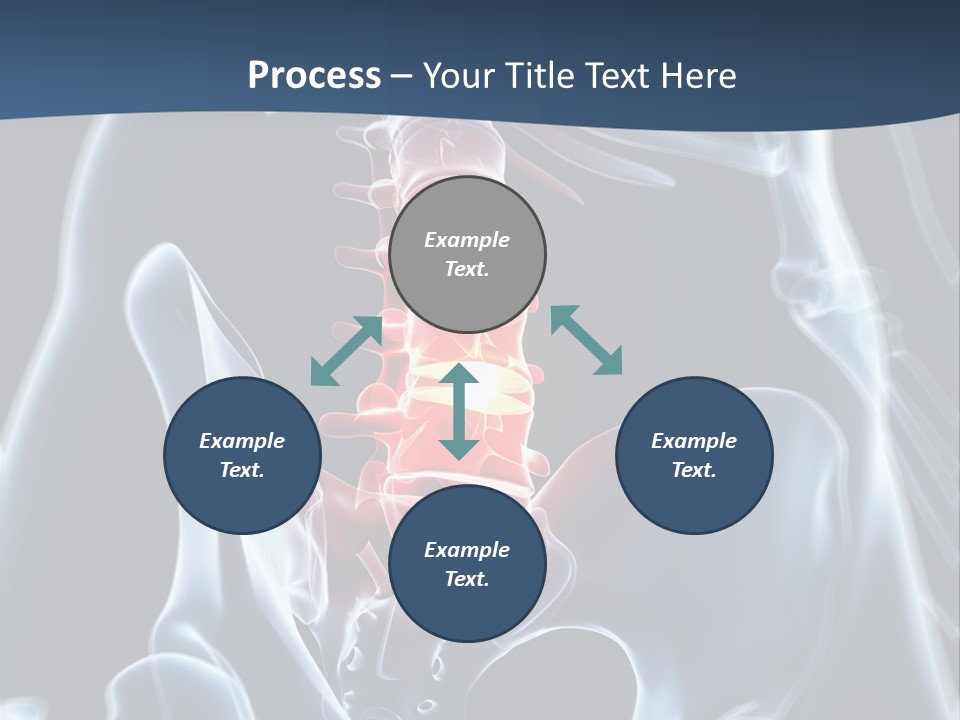 Prolapse Nerve Canal PowerPoint Template