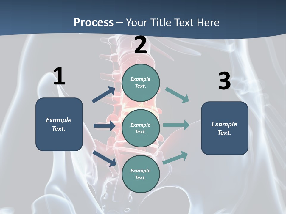 Prolapse Nerve Canal PowerPoint Template