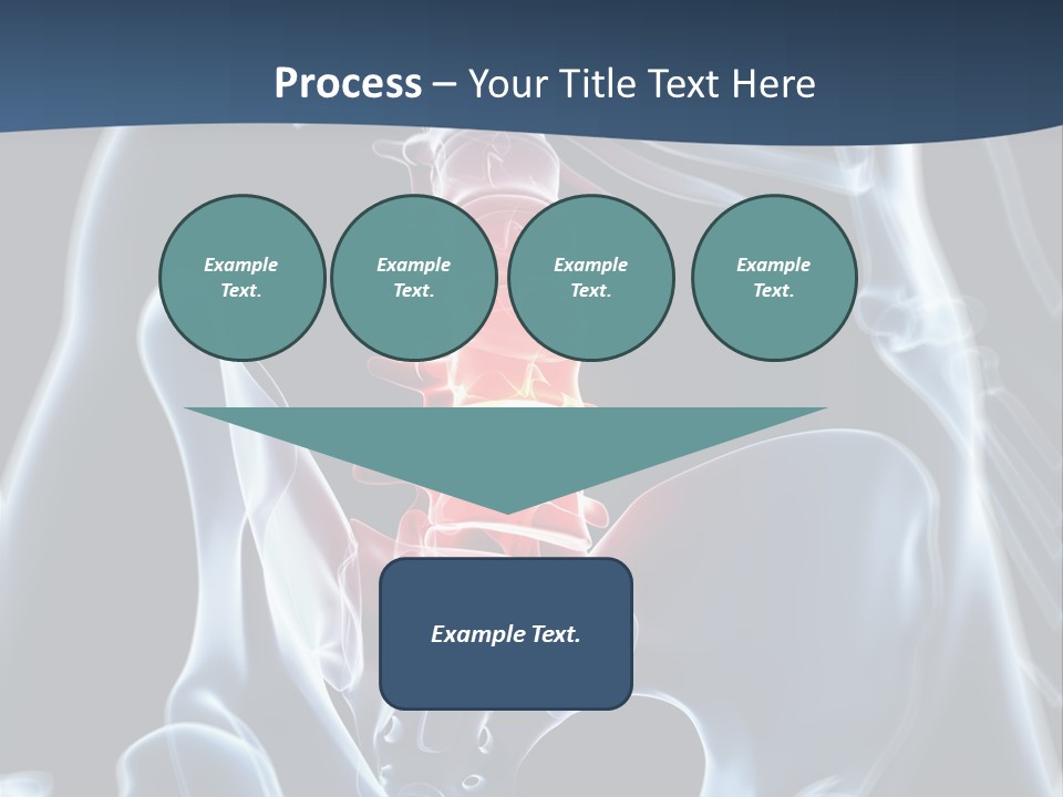 Prolapse Nerve Canal PowerPoint Template