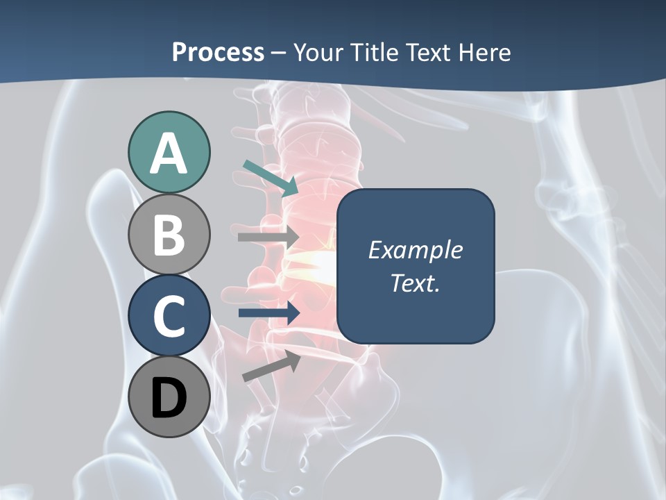 Prolapse Nerve Canal PowerPoint Template
