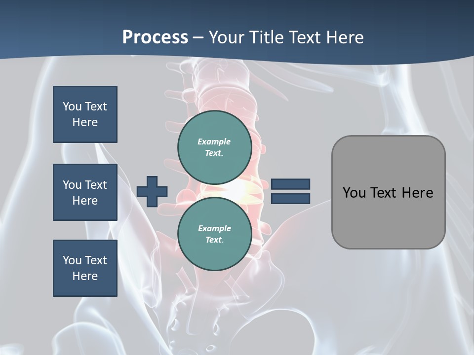 Prolapse Nerve Canal PowerPoint Template