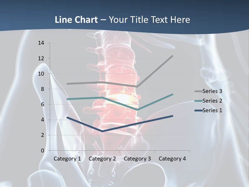 Prolapse Nerve Canal PowerPoint Template