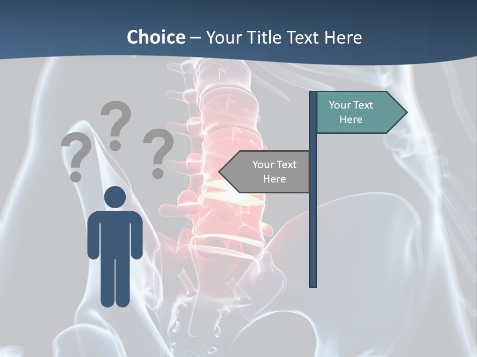 Prolapse Nerve Canal PowerPoint Template