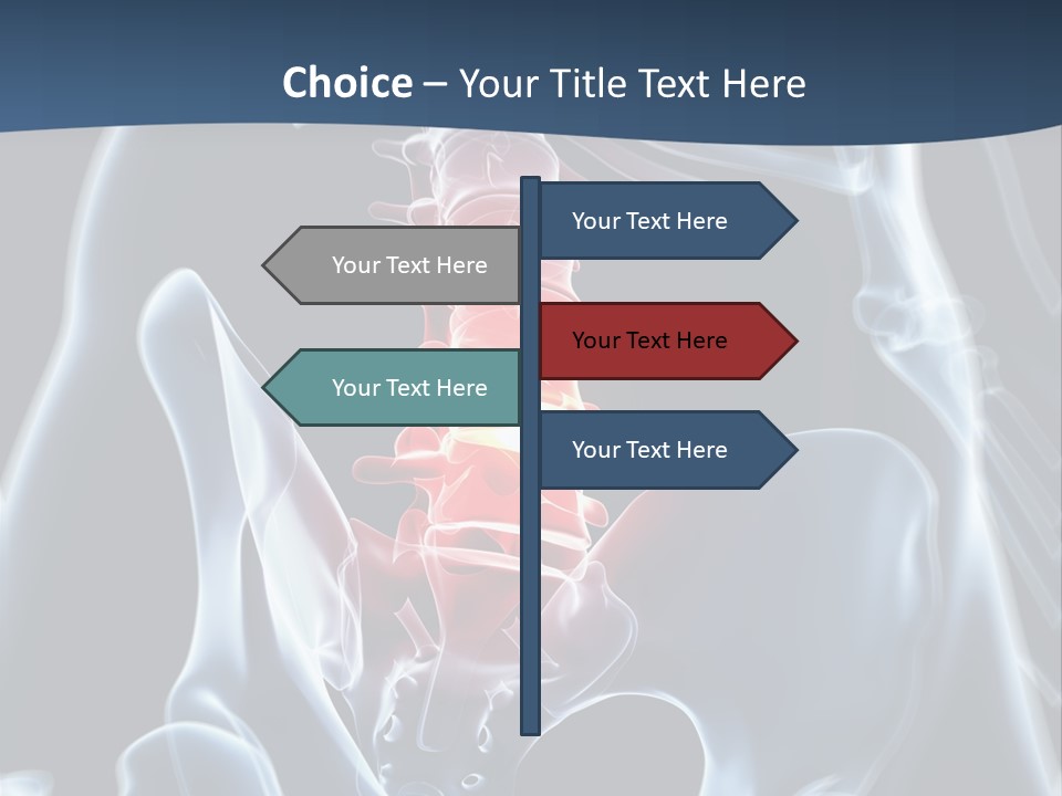 Prolapse Nerve Canal PowerPoint Template