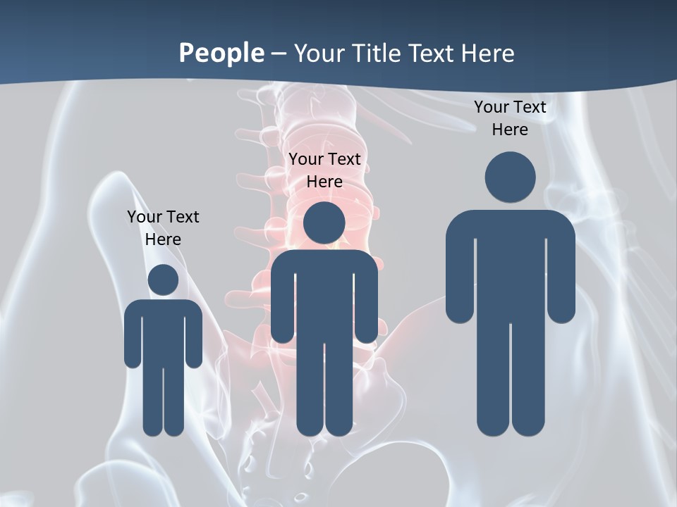Prolapse Nerve Canal PowerPoint Template