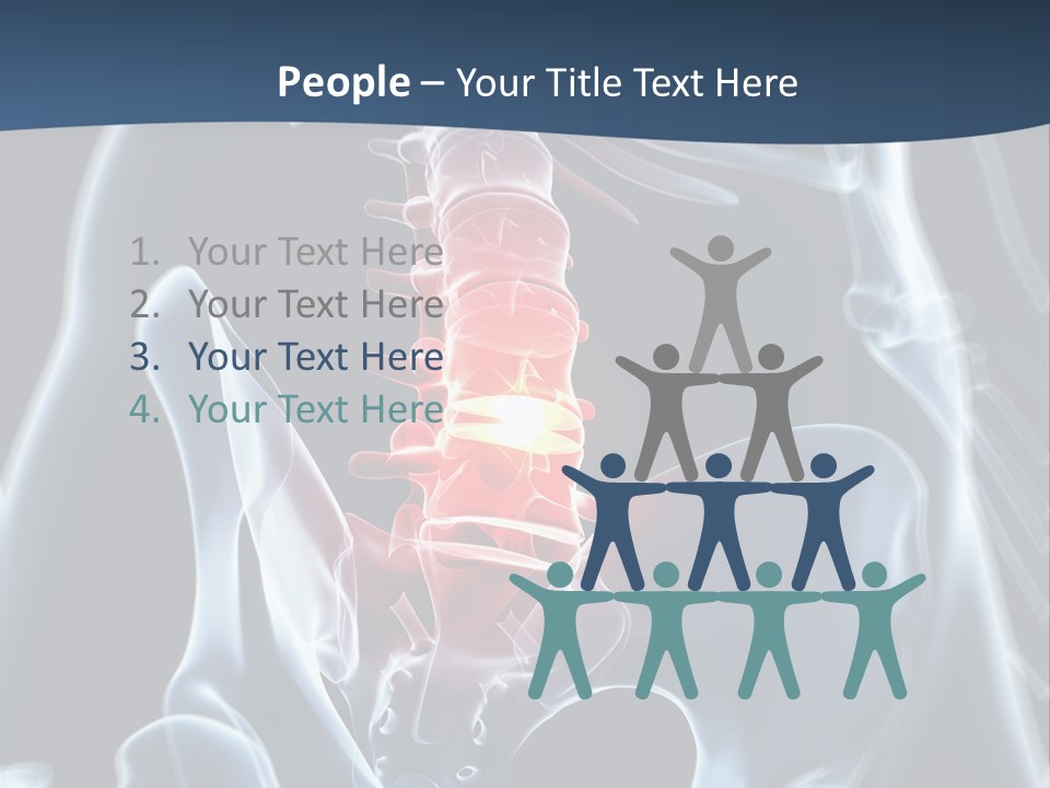 Prolapse Nerve Canal PowerPoint Template