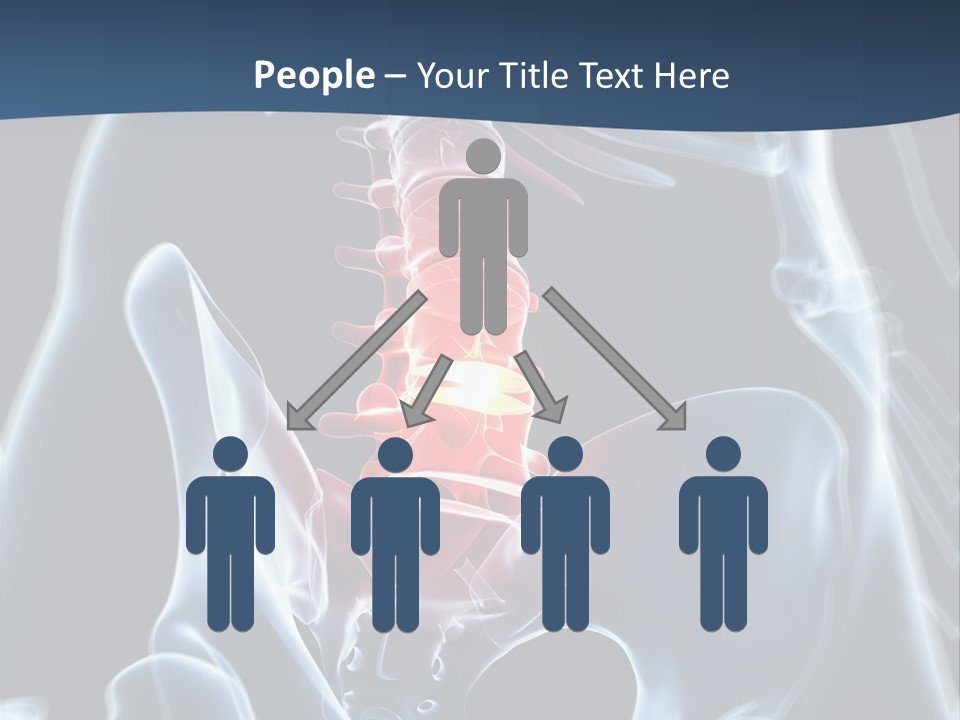 Prolapse Nerve Canal PowerPoint Template