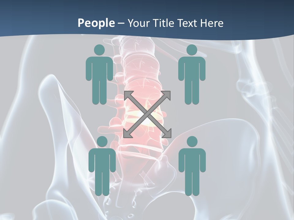 Prolapse Nerve Canal PowerPoint Template
