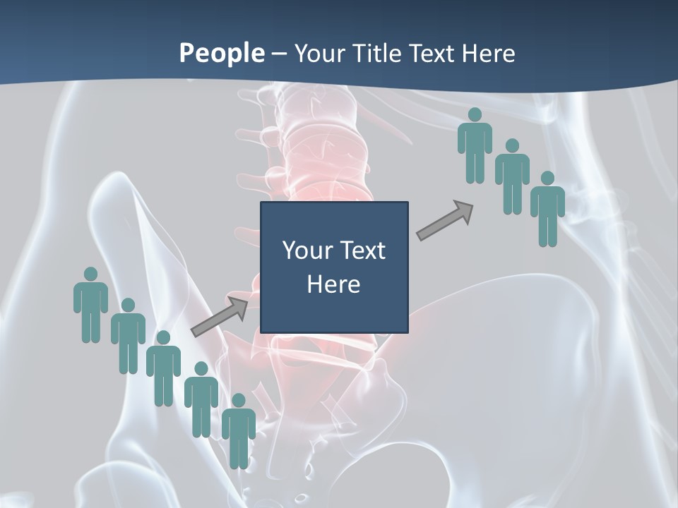 Prolapse Nerve Canal PowerPoint Template