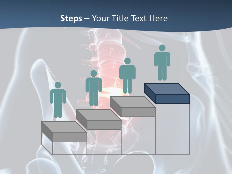 Prolapse Nerve Canal PowerPoint Template