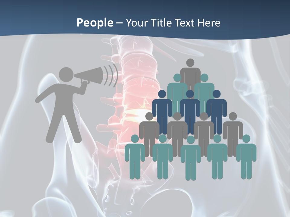 Prolapse Nerve Canal PowerPoint Template