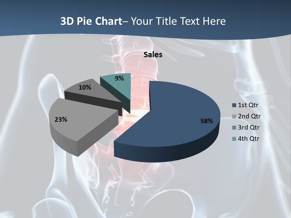 Prolapse Nerve Canal PowerPoint Template