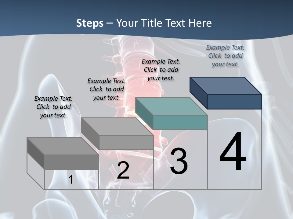 Prolapse Nerve Canal PowerPoint Template