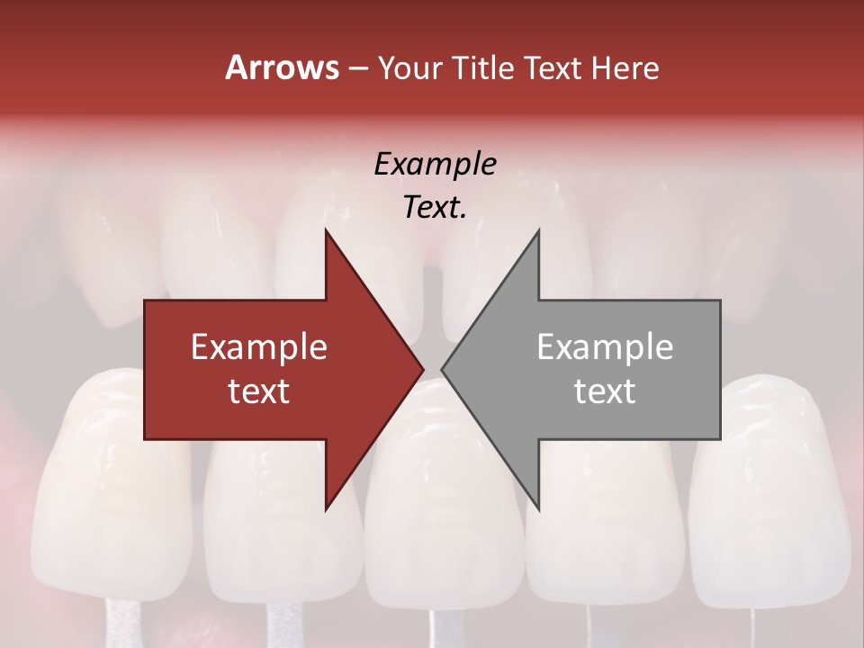 Aesthetic Orthodontic Lips PowerPoint Template