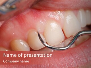 Examination Dental Procedure PowerPoint Template