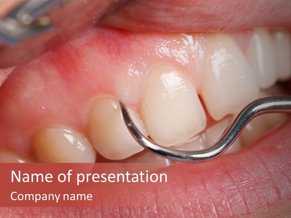 Examination Dental Procedure PowerPoint Template