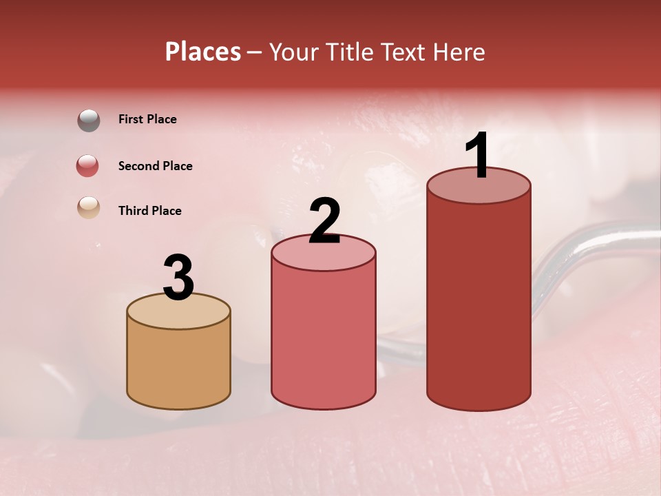 Examination Dental Procedure PowerPoint Template