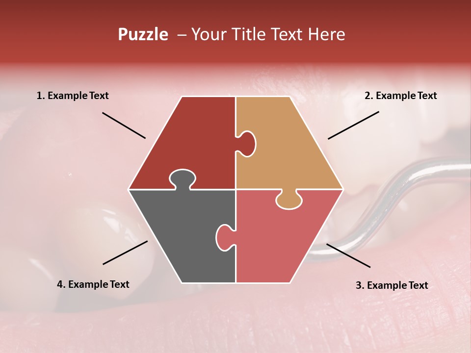 Examination Dental Procedure PowerPoint Template