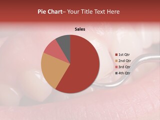 Examination Dental Procedure PowerPoint Template