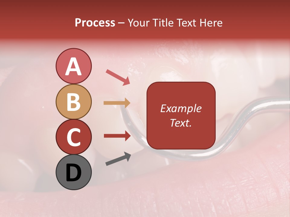 Examination Dental Procedure PowerPoint Template