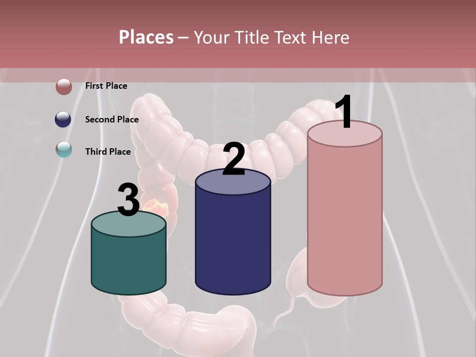 Vitals Digestive Tumor PowerPoint Template