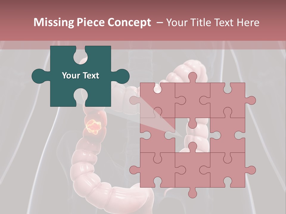 Vitals Digestive Tumor PowerPoint Template
