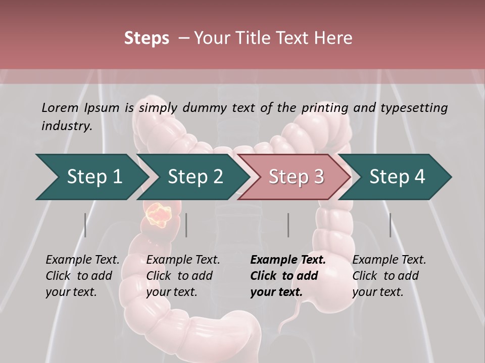 Vitals Digestive Tumor PowerPoint Template
