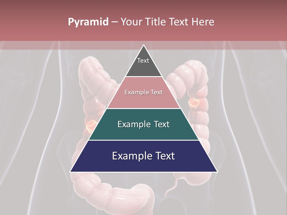 Vitals Digestive Tumor PowerPoint Template
