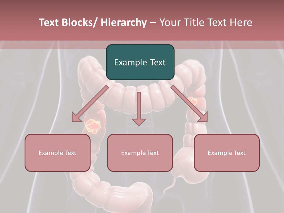 Vitals Digestive Tumor PowerPoint Template