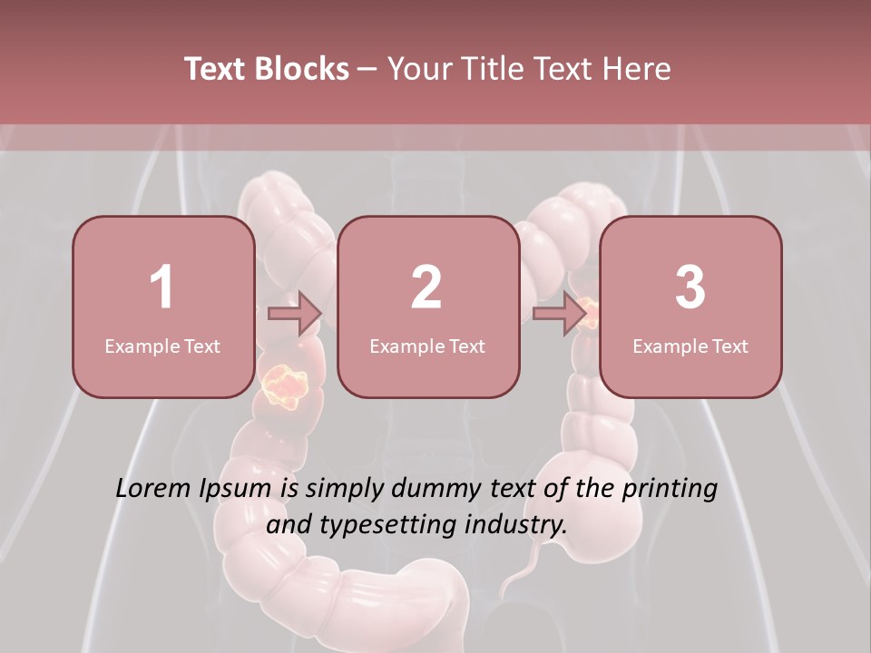 Vitals Digestive Tumor PowerPoint Template