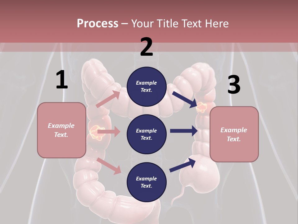 Vitals Digestive Tumor PowerPoint Template