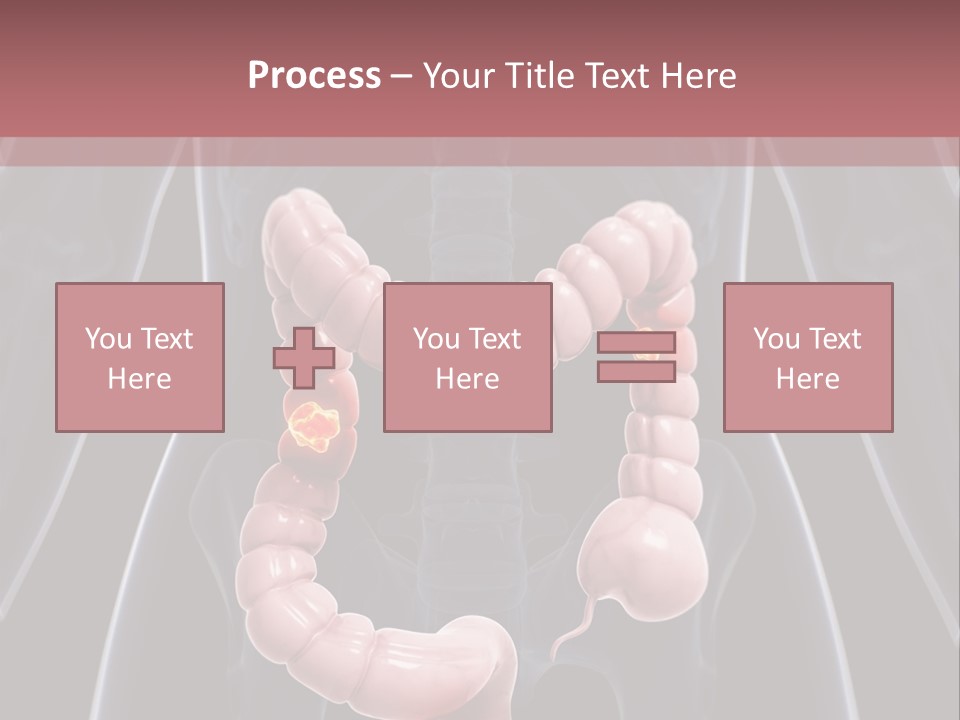 Vitals Digestive Tumor PowerPoint Template