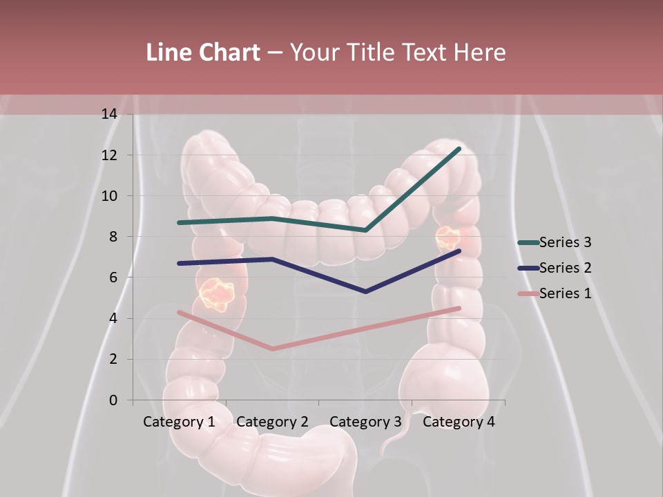 Vitals Digestive Tumor PowerPoint Template
