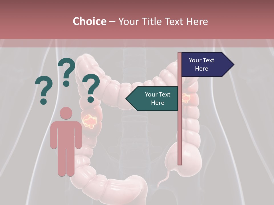 Vitals Digestive Tumor PowerPoint Template