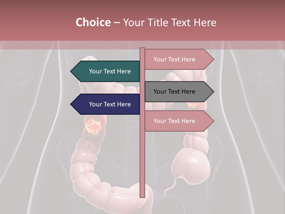 Vitals Digestive Tumor PowerPoint Template